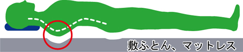 25-6-3-1